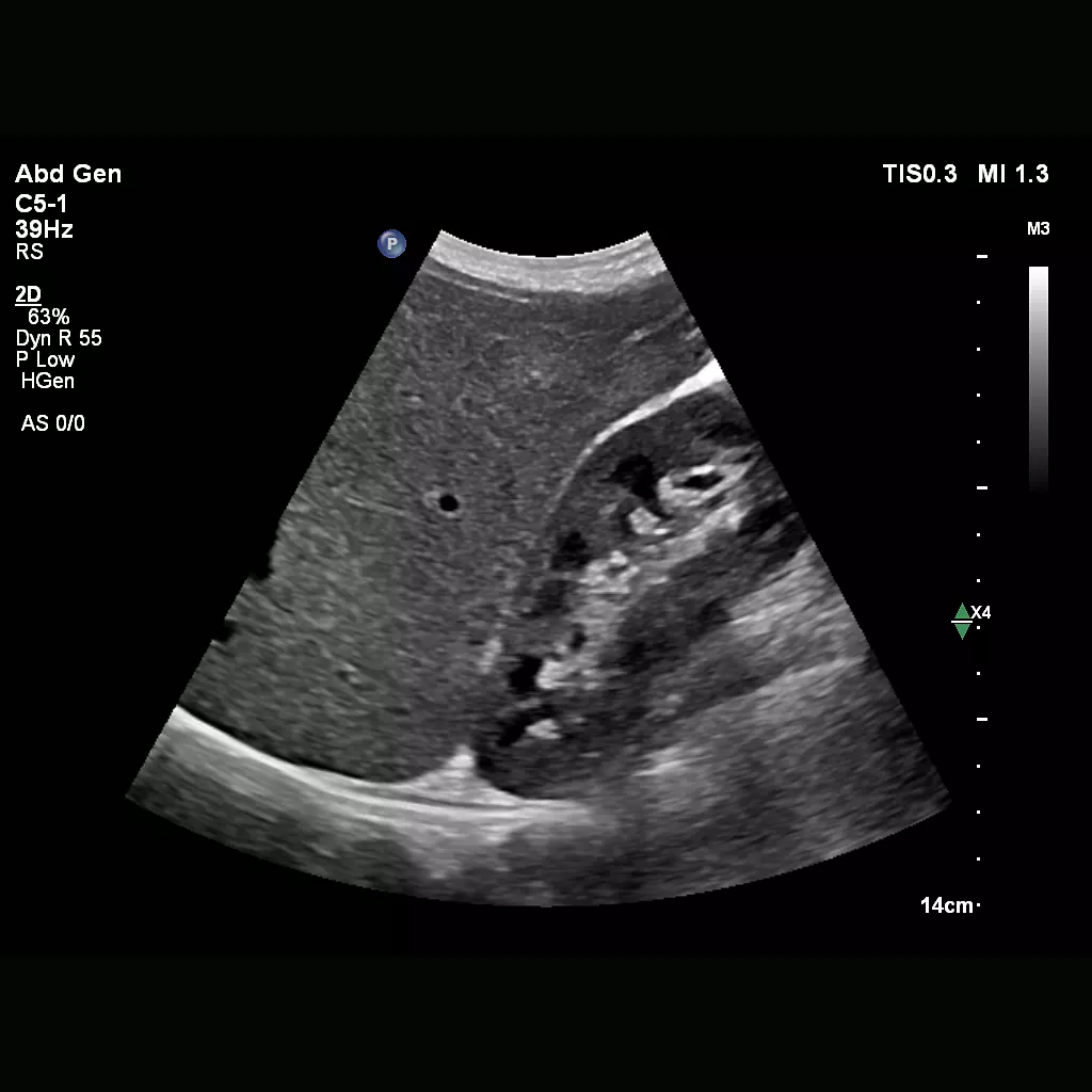 Next Gen Auto Scan