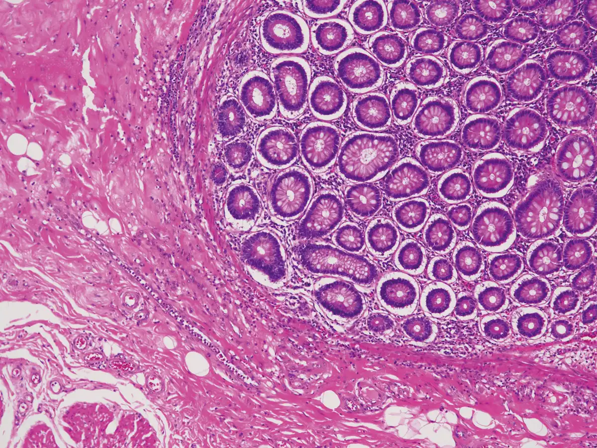 High color rendering LED light source