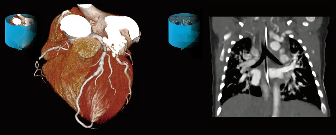 ONE_Rotation_Scanning