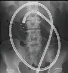 逆时插入 逆时插入