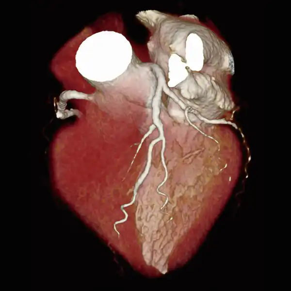 SURECardio_Prospective