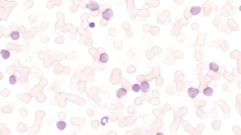 With low-powered objective