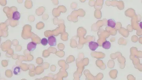 With high-powered objective