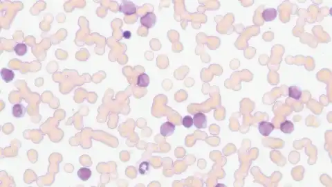 With low-powered objective