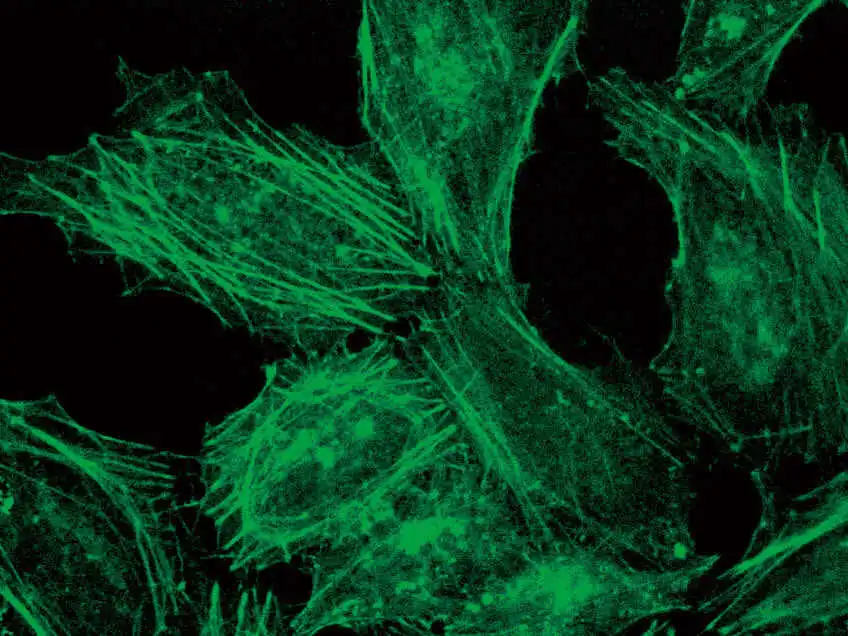Diascopic fluorescence observation
