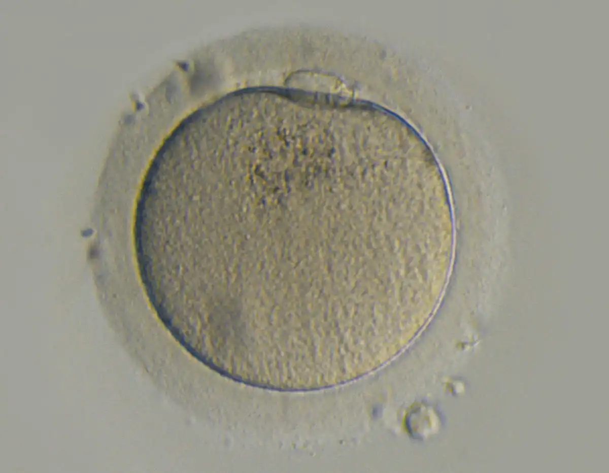 “Emboss Contrast”反差技术