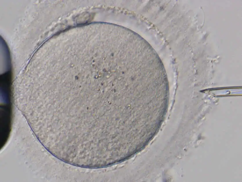 Nikon Advanced Modulation Contrast (NAMC) observation