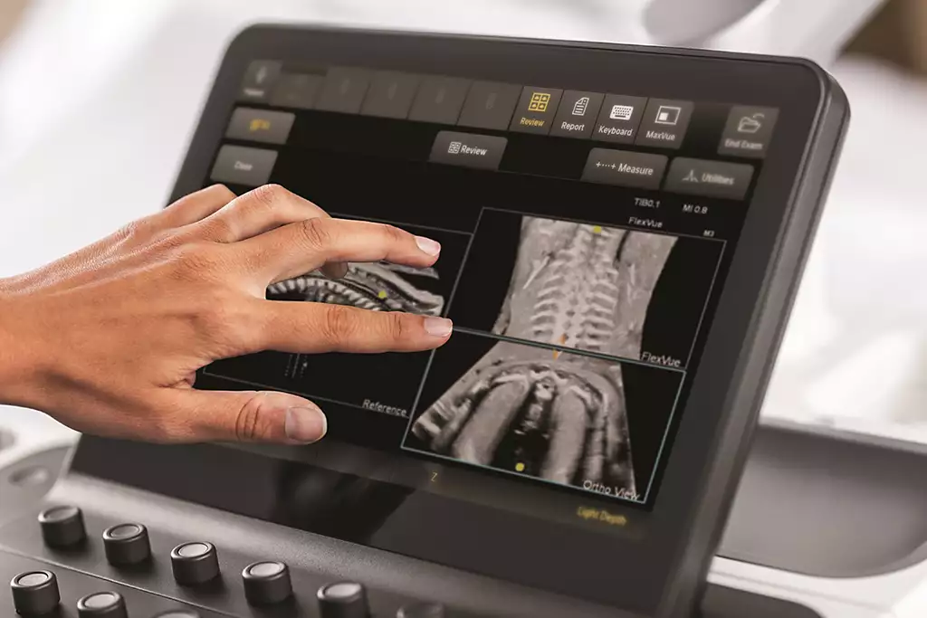 TrueVue advanced 3D display