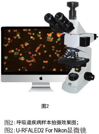 呼吸道疾病效果图 呼吸道疾病效果图