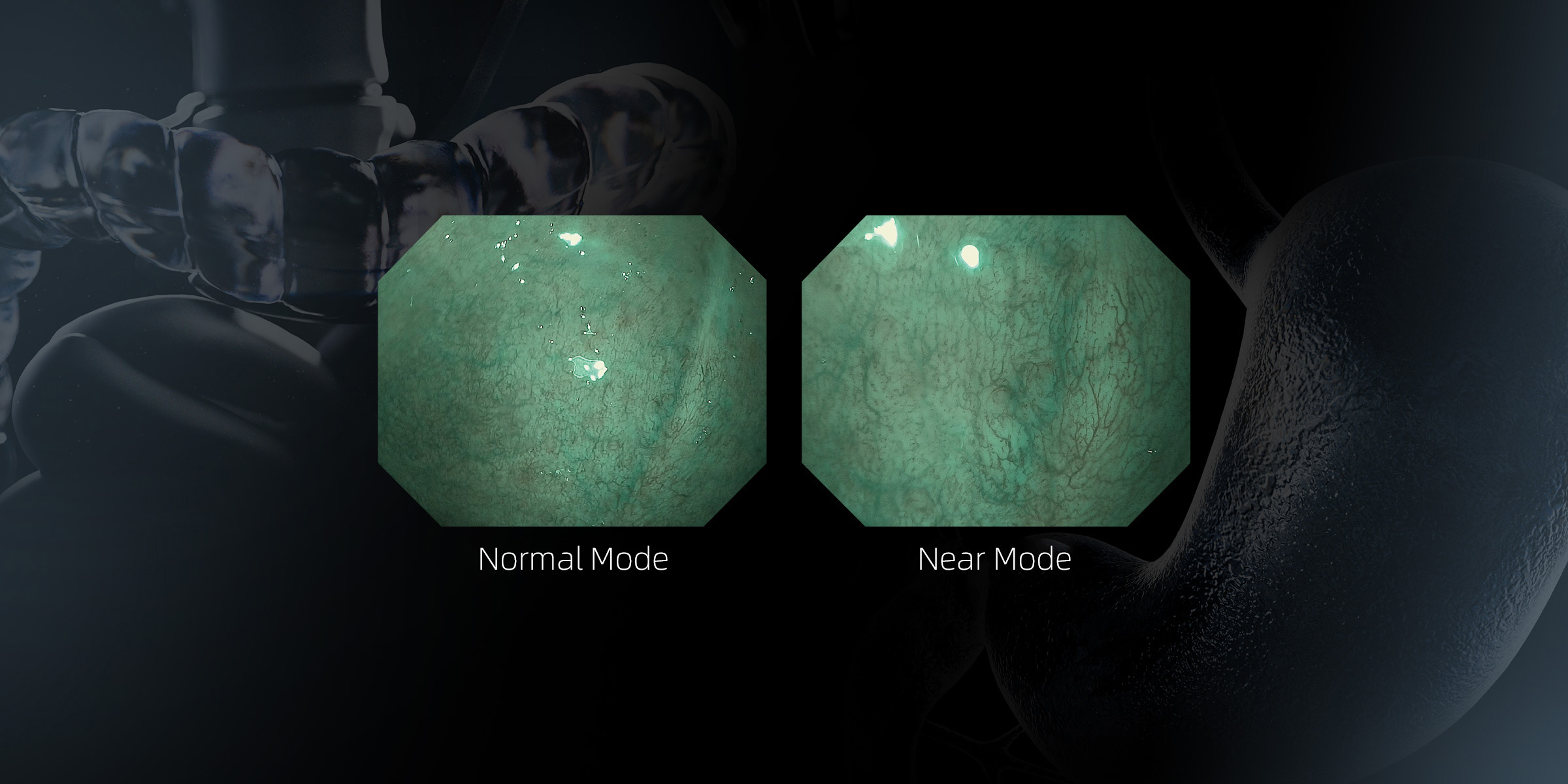 Dual Focus