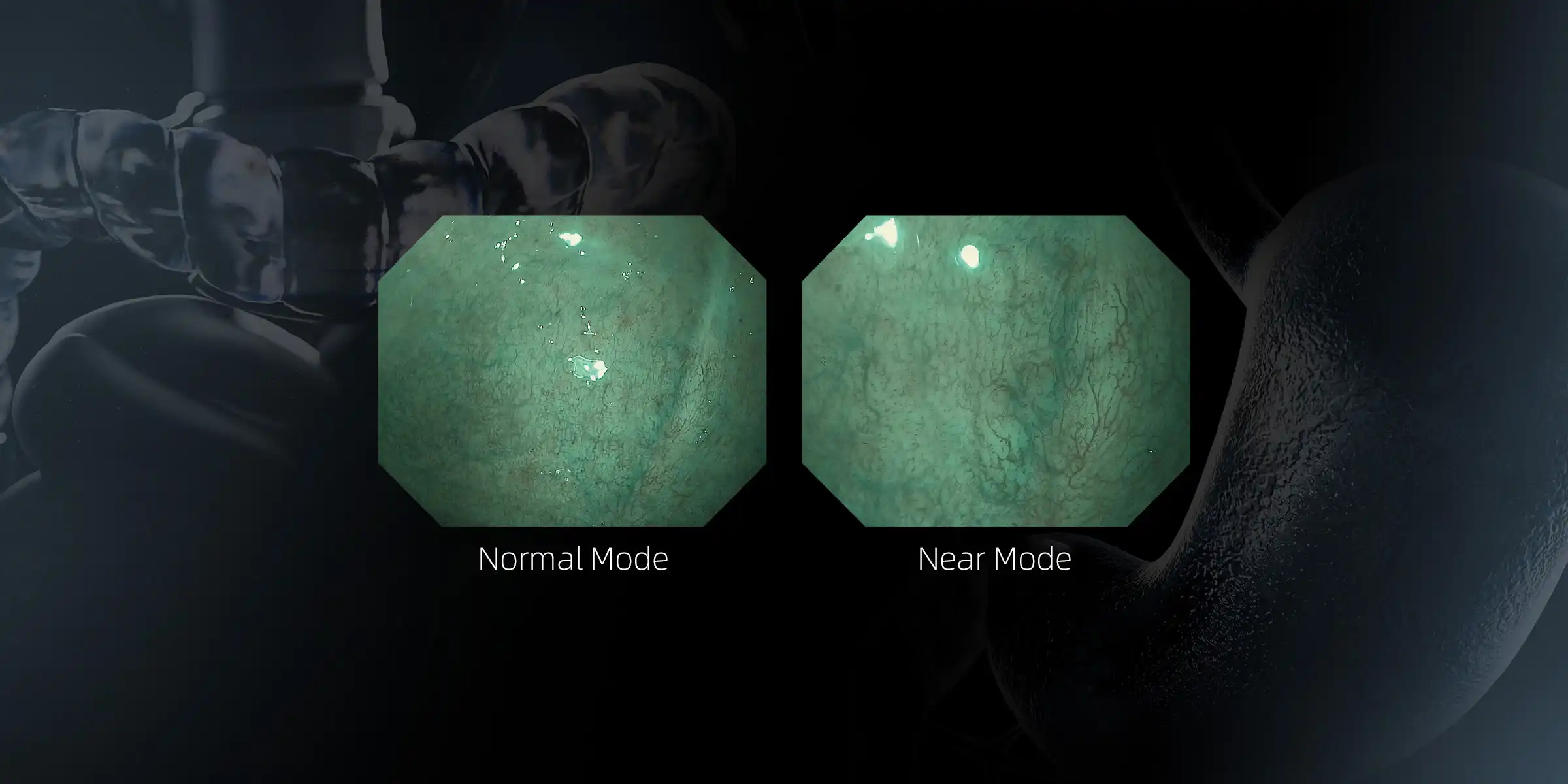 Dual Focus