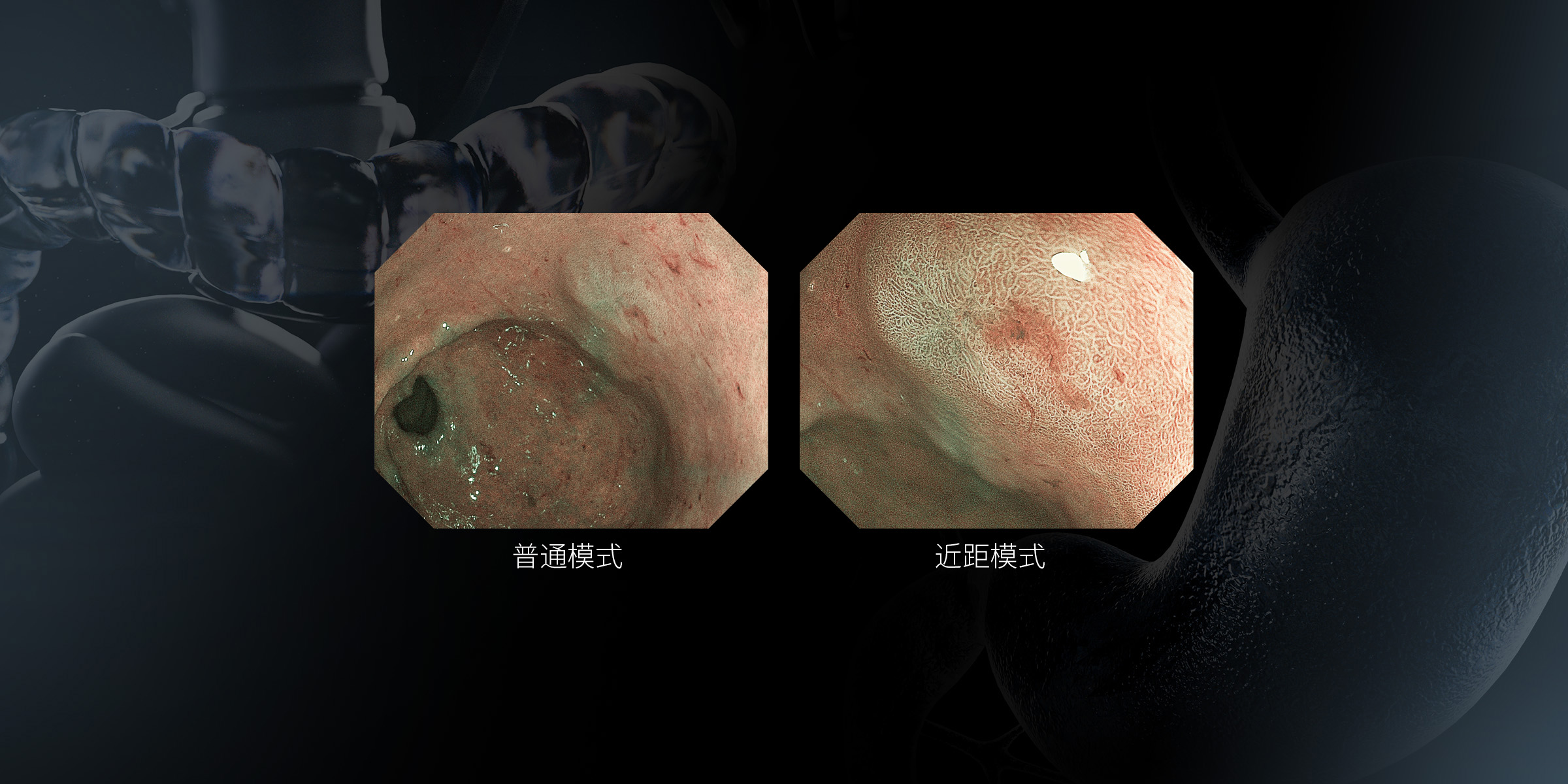 一键双焦
