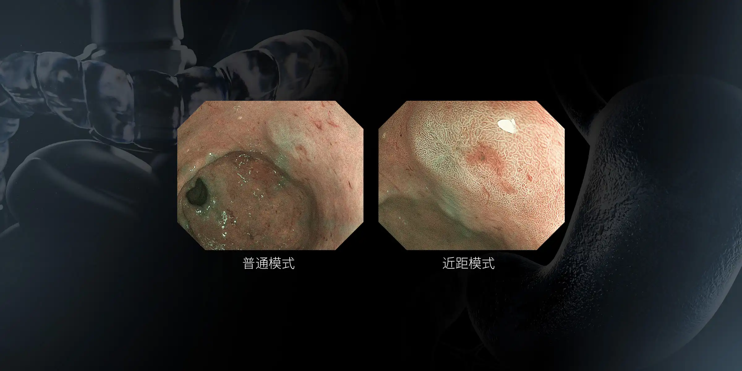 一键双焦
