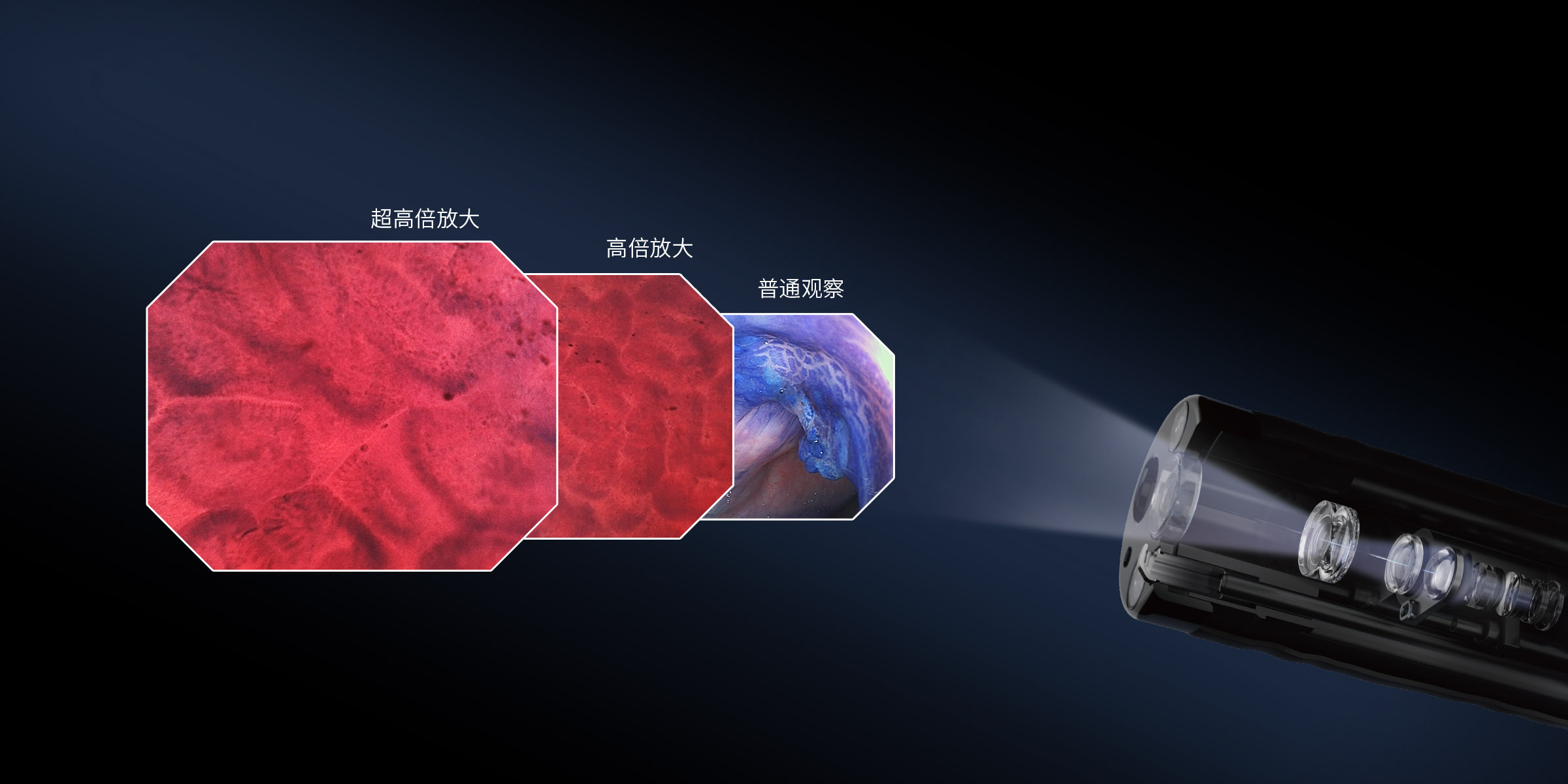 多种放大模式切换