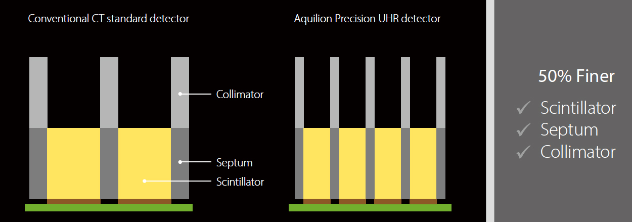 UHR Detector System
