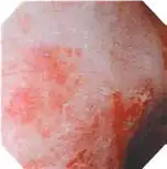 常规图像 常规图像