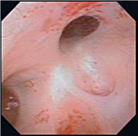 The image of URF-V