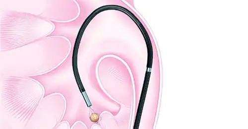 275° 宽角度范围