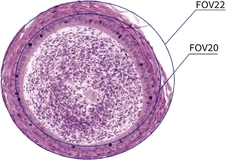 Observation with FOV