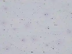 铝合金 — 明场